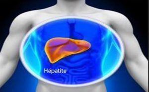 Lire la suite à propos de l’article Testé positif de l&rsquo;Hépatite B Chronique : Hépatite B Remède et Conduite à Tenir