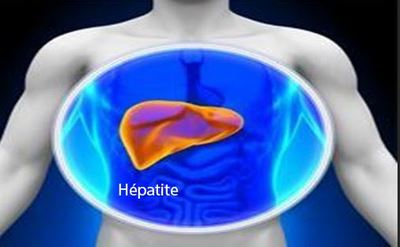 Lire la suite à propos de l’article Testé positif de l&rsquo;Hépatite B Chronique : Hépatite B Remède et Conduite à Tenir