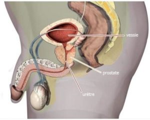 Lire la suite à propos de l’article Comment Eviter la Prostate ? Prostatite Traitement Naturel Par les Plantes