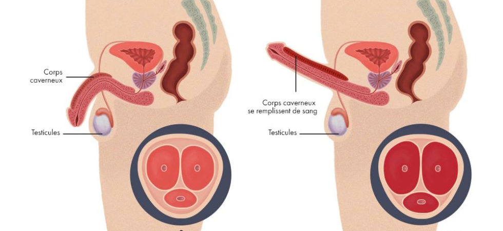 Traitement Naturel Dysfonction Erectile Soin Naturel dysfonction érectile remède naturel, voici ce qu'il vous faut comme traitement erectile_dysfunction
