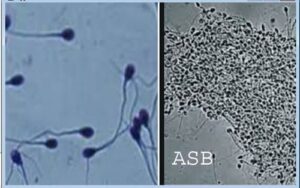 Lire la suite à propos de l’article L&rsquo;Asthenozoospermie: Traitement naturel contre l&rsquo;Asthenozoospermie