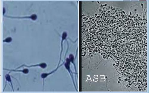 Lire la suite à propos de l’article L&rsquo;Asthenozoospermie: Traitement naturel contre l&rsquo;Asthenozoospermie