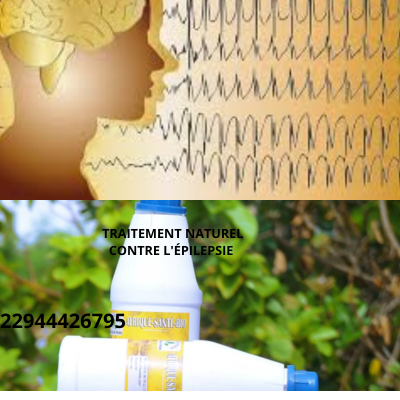 Lire la suite à propos de l’article Causes de l&rsquo;Épilepsie : Traitement naturel contre l&rsquo;épilepsie